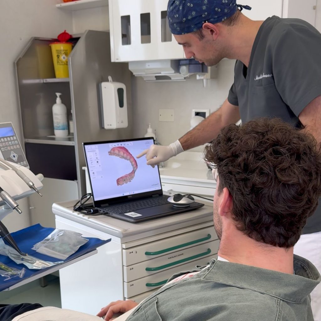 Faccette Dentali 5 apparecchio trasparente a Crema - faccette dentali