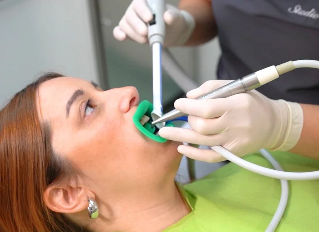 Pulizia dentale moderna: perché scegliere la GBT 2 pulizia dentale moderna