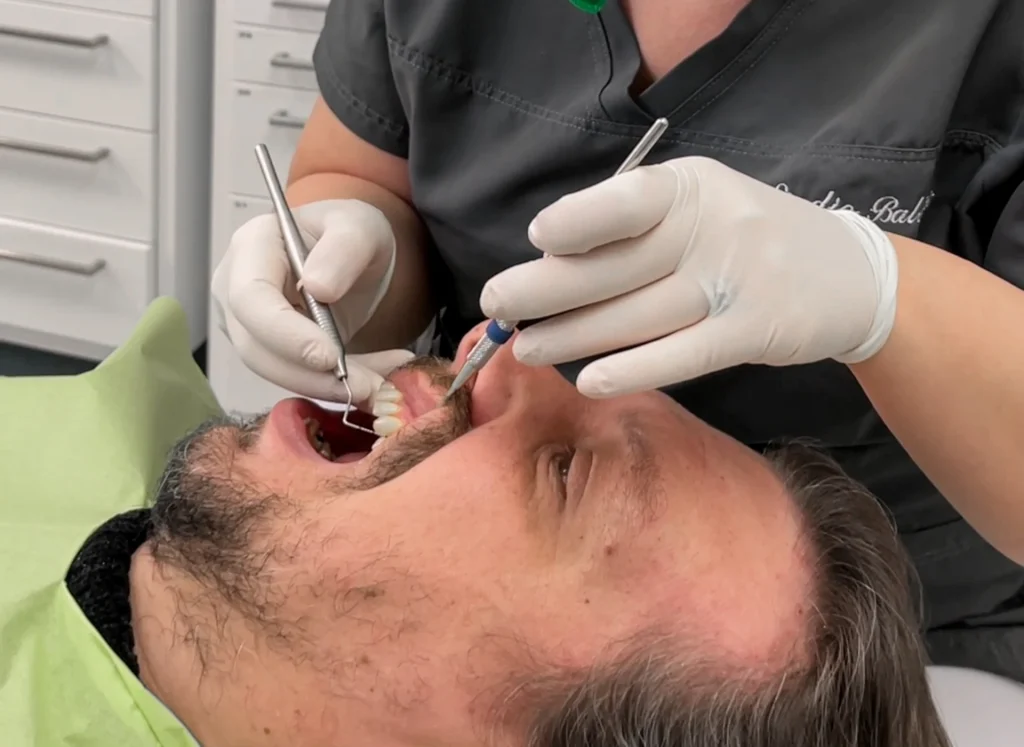 Gengive che si ritirano: paura di perdere il sorriso 1 Gengive che si ritirano