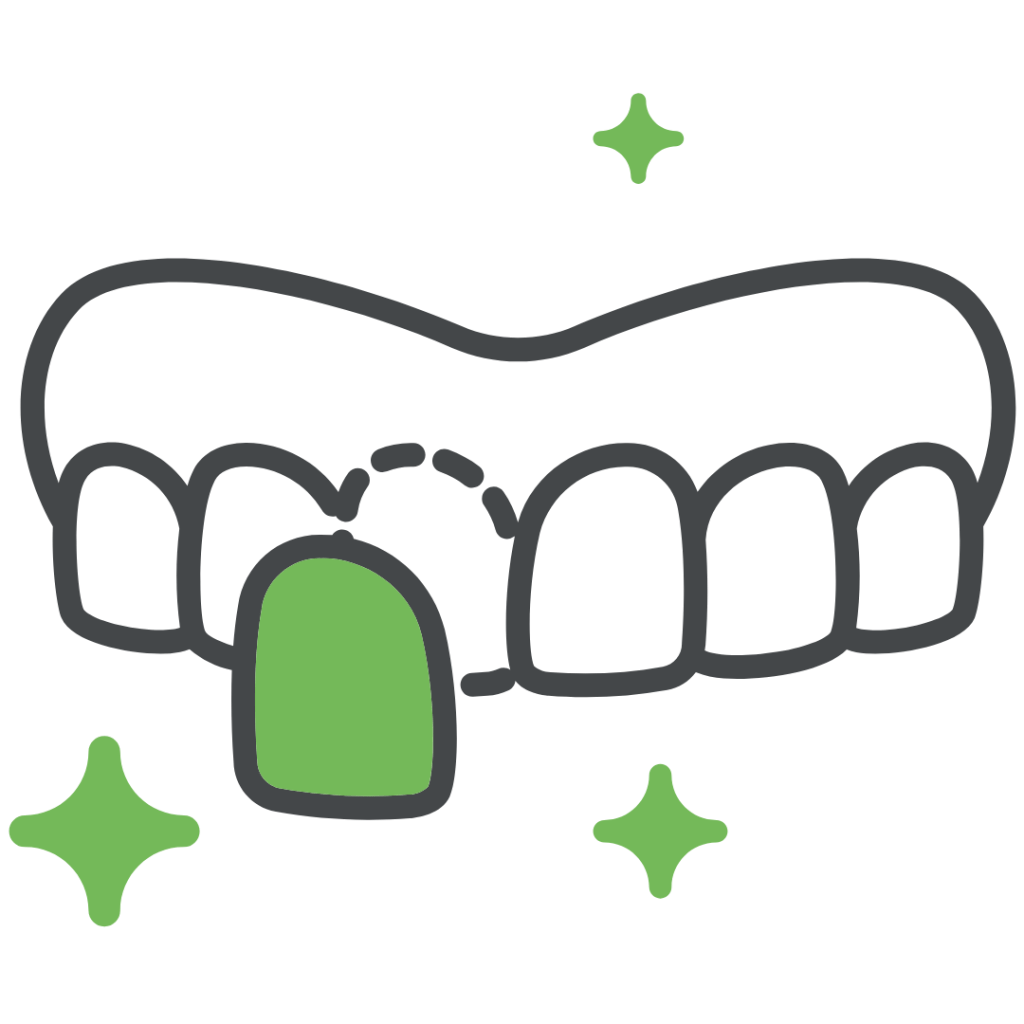 Home 11 Faccette dentali