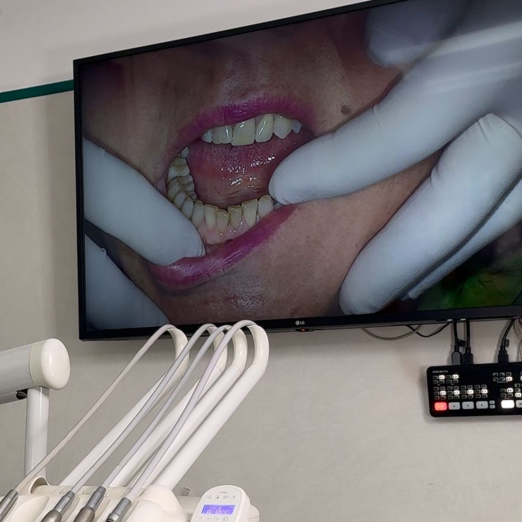 Parodontologia 1 parodontite a Crema - come curare la parodontite ai denti