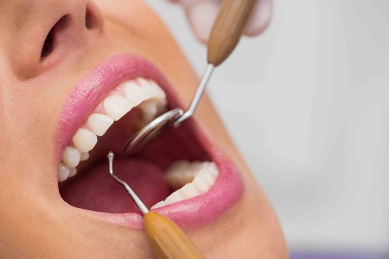 Blog 1 Cosa fare prima di una pulizia dei denti