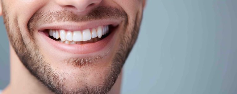 mantenere i denti bianchi dopo lo sbiancamento